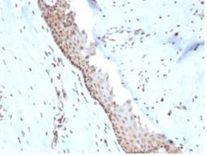 Immunohistochemical analysis of formalin-fixed, paraffin-embedded human cervix tissue using Anti-NME1 Antibody [NME1/2738]