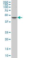 Anti-GSDMB Mouse Monoclonal Antibody [clone: 4C10]