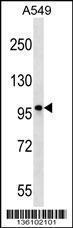 Anti-CCDC141 Rabbit Polyclonal Antibody (AP (Alkaline Phosphatase))