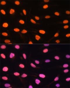 Immunofluorescence analysis of U-2 OS cells using Anti-DREF Antibody (A9996) at a dilution of 1:100 DAPI was used to stain the cell nuclei (blue)