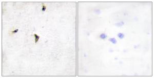 Immunohistochemical analysis of paraffin-embedded human brain tissue using Anti-KCNB1 Antibody. The right hand panel represents a negative control, where the antibody was pre-incubated with the immunising peptide