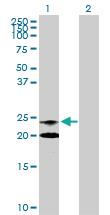 Anti-NAAA Rabbit Polyclonal Antibody