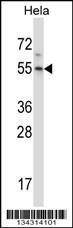 Anti-HM13 Rabbit Polyclonal Antibody (HRP (Horseradish Peroxidase))