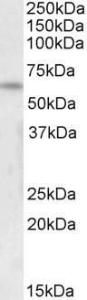 Antibody anti-FOXK2 100 µg