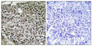 Anti-NFAT3 antibody