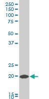 Anti-COMMD1 Mouse Polyclonal Antibody