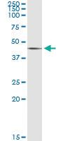 Anti-SGK2 Antibody Pair