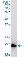 Anti-COMMD1 Mouse Polyclonal Antibody