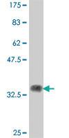 Anti-DGCR14 Mouse Polyclonal Antibody