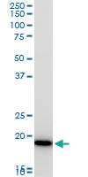 Anti-COMMD1 Mouse Polyclonal Antibody