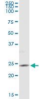 Anti-PIP5K1C Antibody Pair