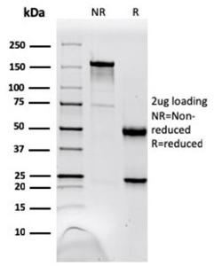 SDS-PAGE analysis of Anti-NME1 Antibody [NME1/2738] under non-reduced and reduced conditions; showing intact IgG and intact heavy and light chains, respectively. SDS-PAGE analysis confirms the integrity and purity of the antibody