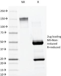 SDS-PAGE analysis of Anti-Lambda Light Chain Antibody [LAM03] under non-reduced and reduced conditions; showing intact IgG and intact heavy and light chains, respectively. SDS-PAGE analysis confirms the integrity and purity of the antibody