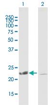 Anti-COMMD1 Mouse Polyclonal Antibody