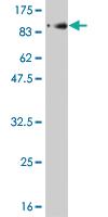 Anti-PLK1 Mouse Monoclonal Antibody [clone: 4G11]