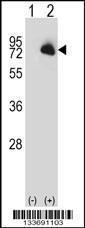 Anti-BTK Rabbit Polyclonal Antibody (HRP (Horseradish Peroxidase))