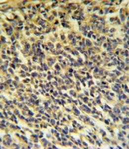 Anti-PLA2G6 Rabbit Polyclonal Antibody