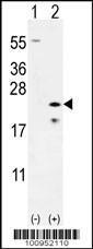 Anti-BAX Rabbit polyclonal antibody unconjugated