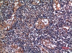 Immunohistochemical analysis of paraffin-embedded human lymph gland using Anti-KRT19 Antibody