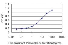 Anti-GSDMB Mouse Monoclonal Antibody [clone: 4C10]