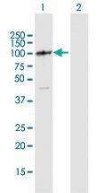 Anti-DIS3L Mouse Polyclonal Antibody