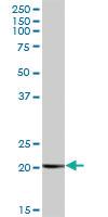 Anti-COMMD1 Mouse Polyclonal Antibody