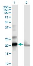 Anti-COMMD1 Mouse Polyclonal Antibody