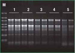 Plant RNA Purification Mini Kit, GeneJET™