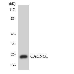 Anti-CACNG1 Rabbit Polyclonal Antibody