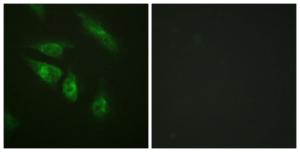 Anti-NFAT3 antibody