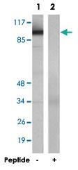 Anti-AR Rabbit Polyclonal Antibody