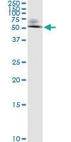 Anti-ODC Antibody Pair