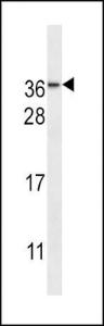 Anti-NMNAT3 Rabbit Polyclonal Antibody