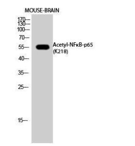 Western blot analysis of mouse brain cells using Anti-NFκB-p65 (acetyl Lys218) Antibody