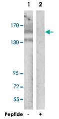 Anti-MAP3K5 Rabbit Polyclonal Antibody