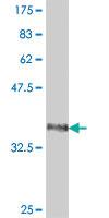 Anti-FBXL21 Mouse Polyclonal Antibody