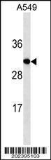 Anti-IGF2 Mouse Monoclonal Antibody [clone: 519CT14.3.6]