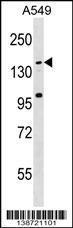 Anti-CCDC144CP Rabbit Polyclonal Antibody (HRP (Horseradish Peroxidase))