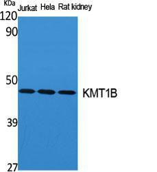 Western blot analysis of various cells using Anti-SUV39H2 Antibody