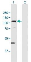 Anti-DIS3L Mouse Polyclonal Antibody