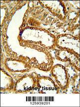 Anti-CCR1 Rabbit Polyclonal Antibody (FITC (Fluorescein Isothiocyanate))