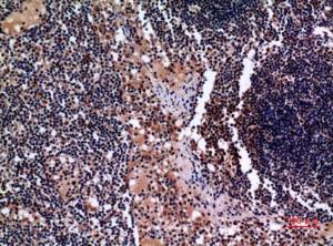 Immunohistochemical analysis of paraffin-embedded human lymph gland using Anti-KRT19 Antibody