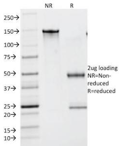 SDS-PAGE analysis of Anti-Lambda Light Chain Antibody [N10/2] under non-reduced and reduced conditions; showing intact IgG and intact heavy and light chains, respectively. SDS-PAGE analysis confirms the integrity and purity of the antibody