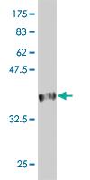 Anti-FBXL21 Mouse Monoclonal Antibody [clone: 4A1]