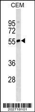 Anti-IGHD Mouse Monoclonal Antibody [clone: 607CT8.4.4]