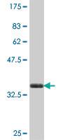 Anti-ABTB1 Mouse Polyclonal Antibody