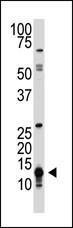 Anti-SUMO Rabbit Polyclonal Antibody (APC (Allophycocyanin))