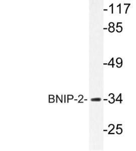 Western blot analysis of lysate from Jurkat cells using Anti-BNIP-2 Antibody