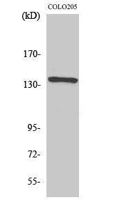 Anti-NFAT3 antibody