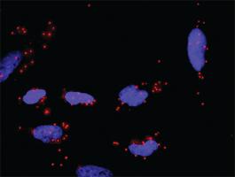 Anti-APBB1 Polyclonal Antibody Pair